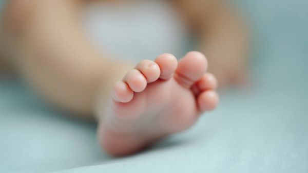 Pied bot : comprendre les impacts de cette malformation congénitale